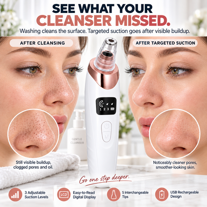 ✨ Electric Pore Vacuum Cleaner – Stop Squeezing 🔥 Start Lifting Visible Pore Buildup