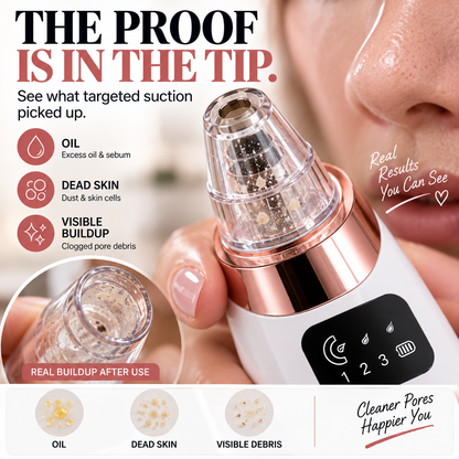 ✨ Electric Pore Vacuum Cleaner – Stop Squeezing 🔥 Start Lifting Visible Pore Buildup