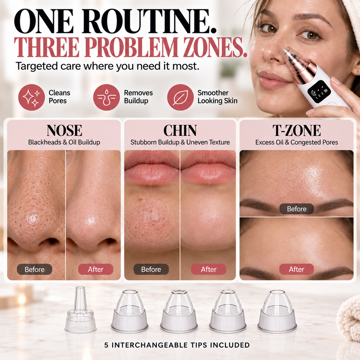✨ Electric Pore Vacuum Cleaner – Stop Squeezing 🔥 Start Lifting Visible Pore Buildup