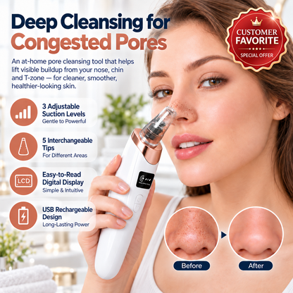 ✨ Electric Pore Vacuum Cleaner – Stop Squeezing 🔥 Start Lifting Visible Pore Buildup
